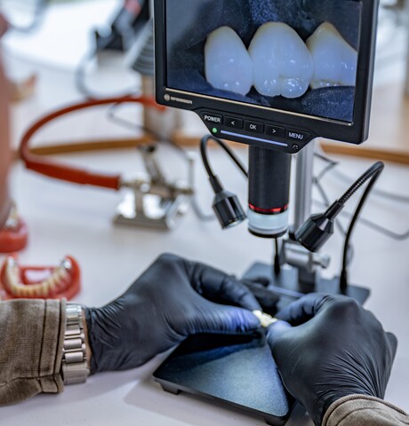 Nahaufnahme der Hände eines Zahntechnikers in schwarzen Schutzhandschuhen, die eine zahntechnische Arbeit unter einem digitalen Bresser-Mikroskop begutachten. Auf dem Monitor ist eine stark vergrößerte Ansicht von fertigen Zahnkronen zu sehen.